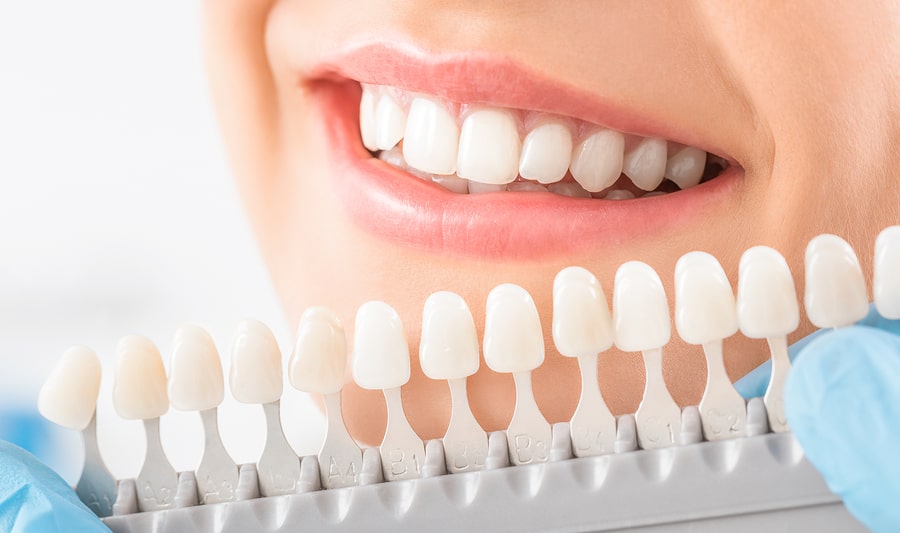 دندانپزشکی زیبایی چیست؟