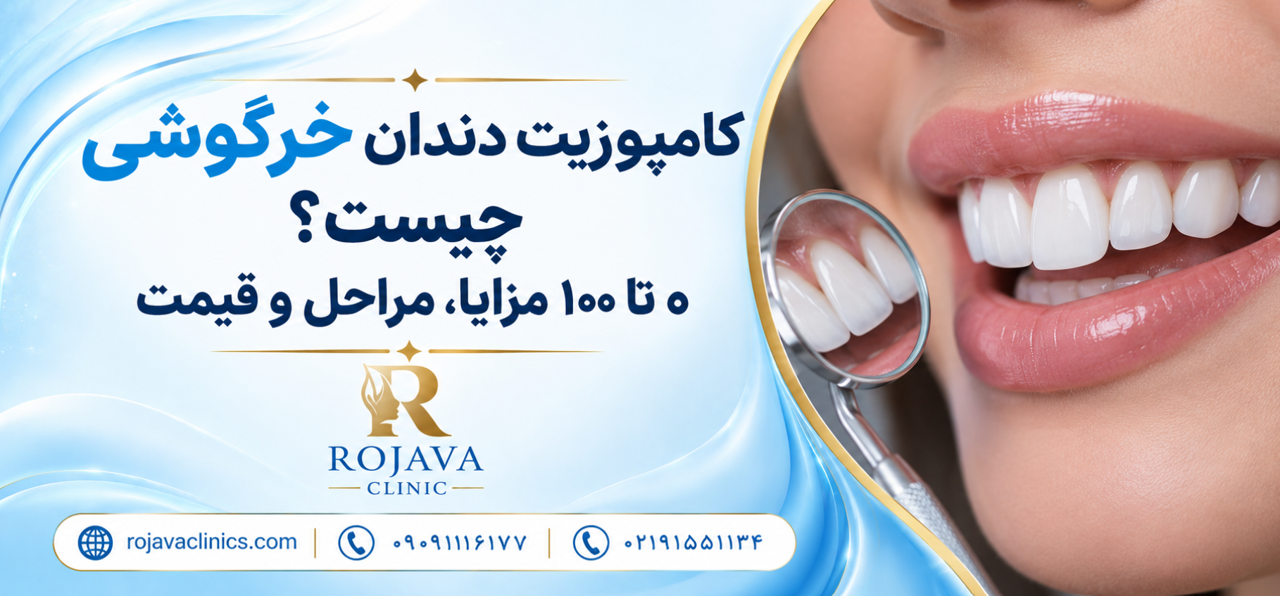 کامپوزیت دندان خرگوشی